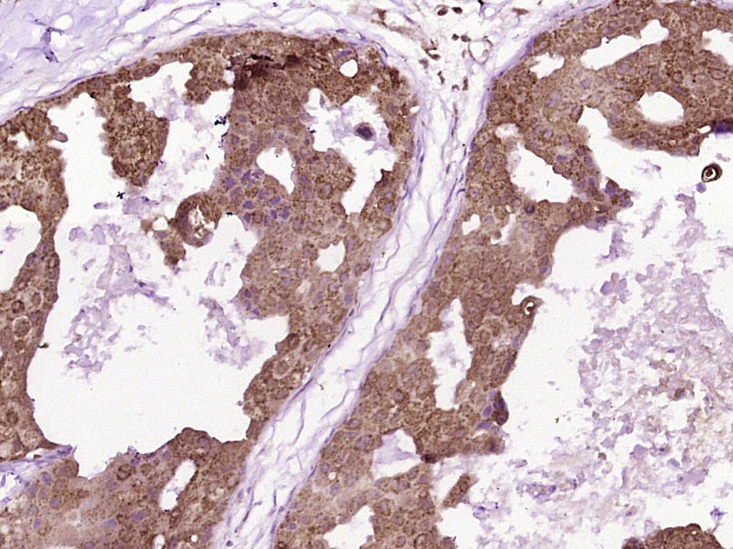 Anti-ST2/IL-1 RL1 Polyclonal Antibody
