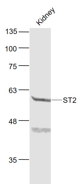 Anti-ST2/IL-1 RL1 Polyclonal Antibody