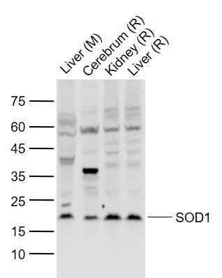 Anti-SOD1 Polyclonal Antibody