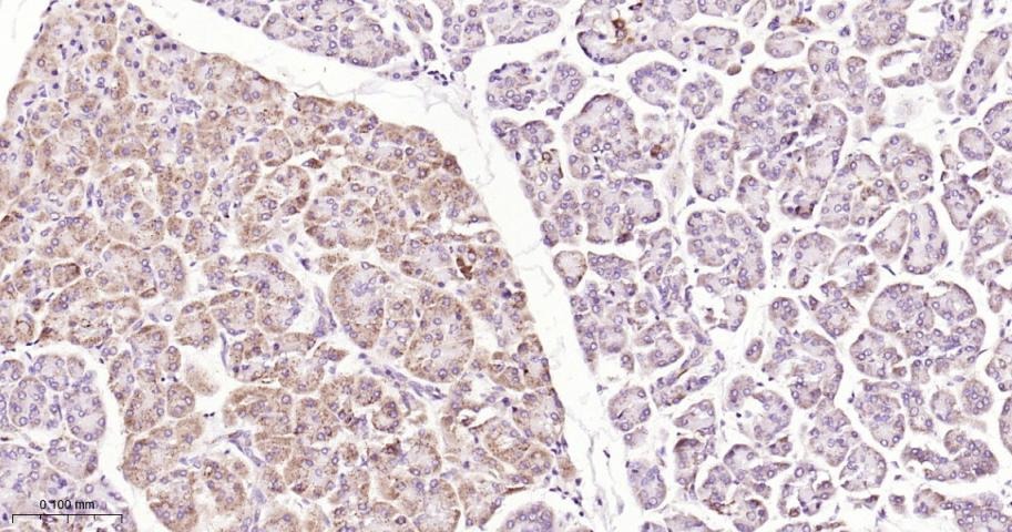 Anti-STAT3 Antibody (9V551)