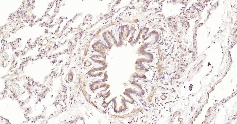 Anti-STAT3 Antibody (3R504)