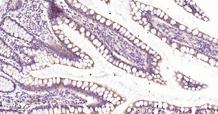 Anti-STAT3 Antibody (9V551)