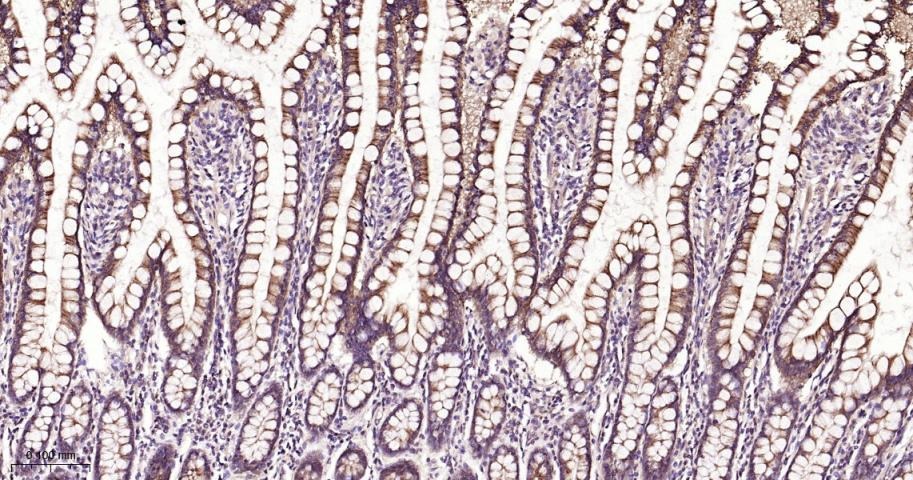 Anti-STAT3 Polyclonal Antibody 2