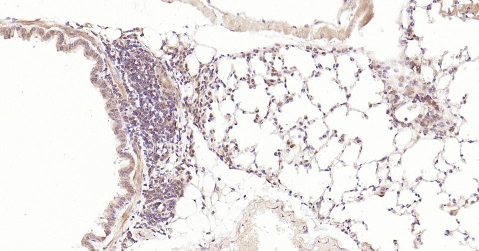 Anti-STAT3 Antibody (3R504)