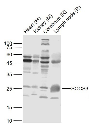 Anti-SOCS3 Polyclonal Antibody