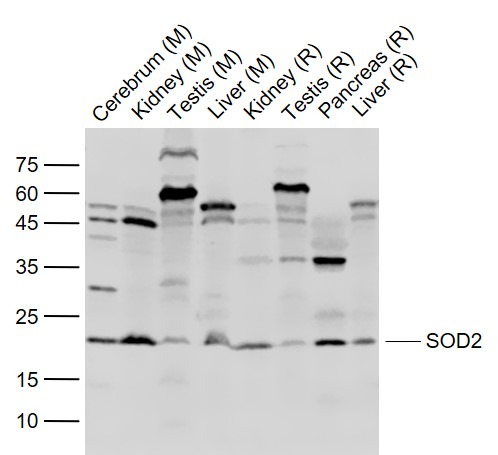 Anti-SOD2 Polyclonal Antibody 2