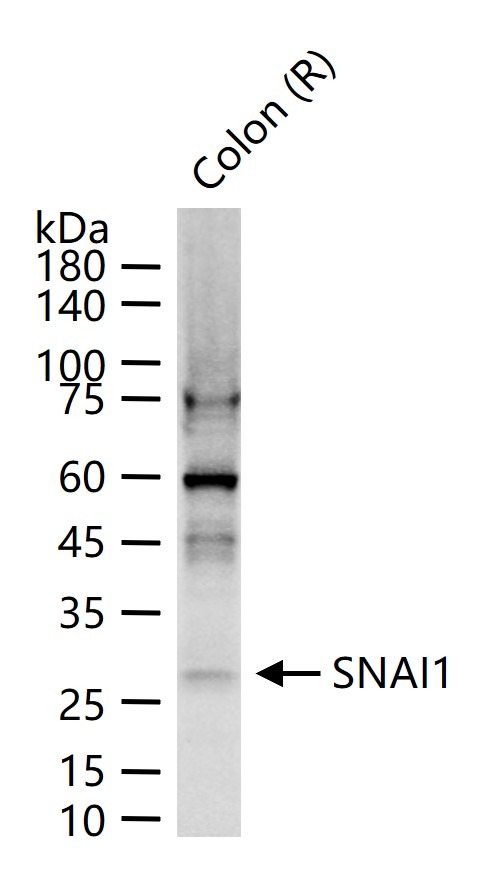 Anti-SNAI1 Polyclonal Antibody