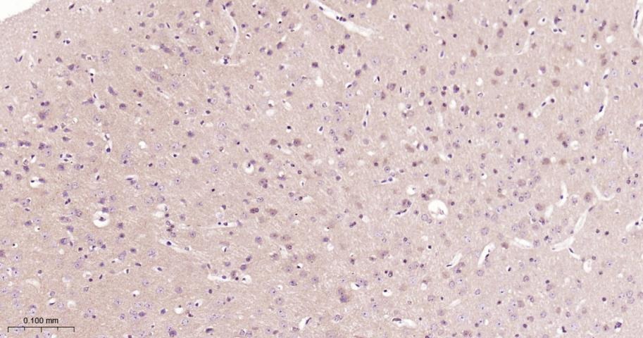 Anti-STAT3 Polyclonal Antibody 2