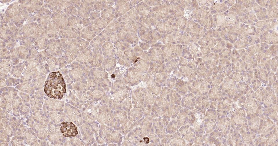 Anti-STAT3 Antibody (3R504)
