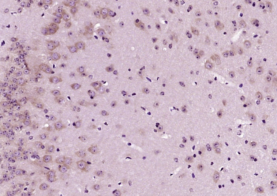 Anti-SOD2 Polyclonal Antibody 2