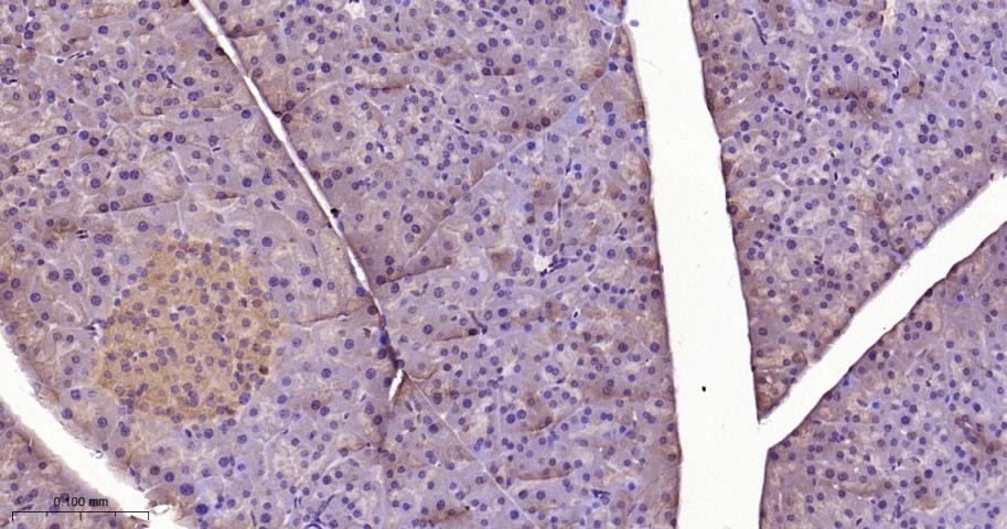 Anti-STAT3 Polyclonal Antibody 2