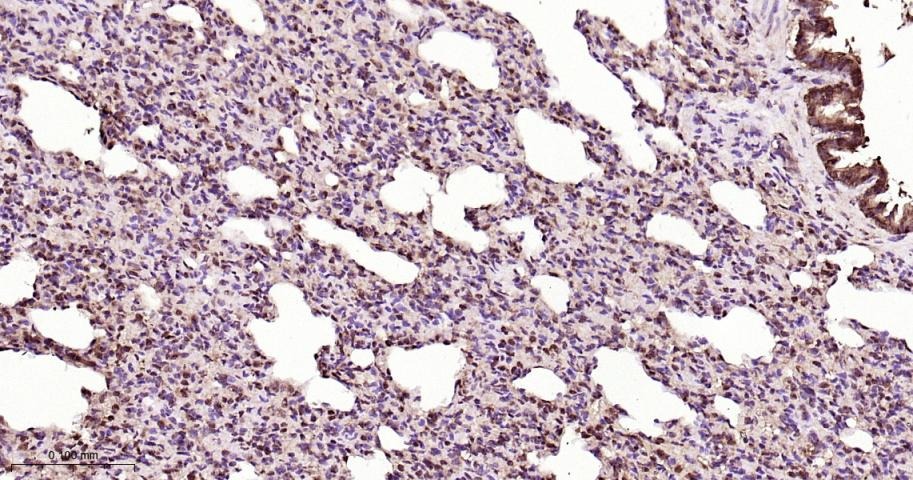 Anti-STAT3 Polyclonal Antibody 2