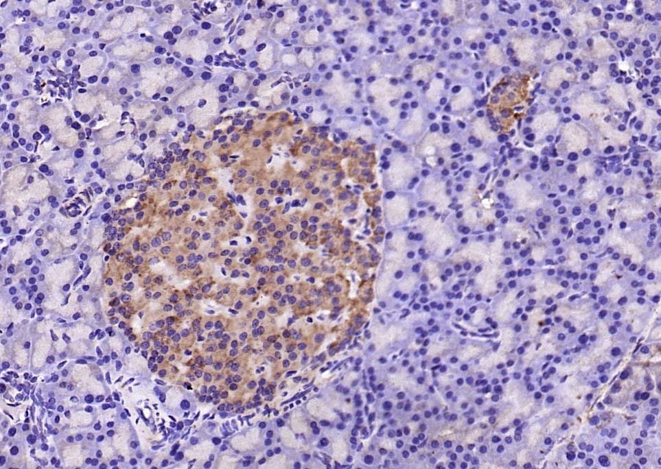 Anti-SOD2 Polyclonal Antibody 2