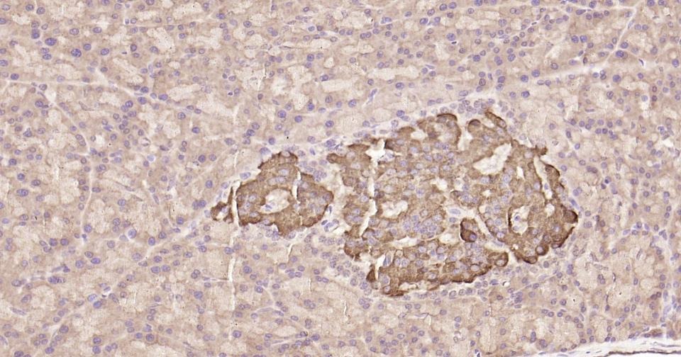 Anti-STAT3 Antibody (3R504)