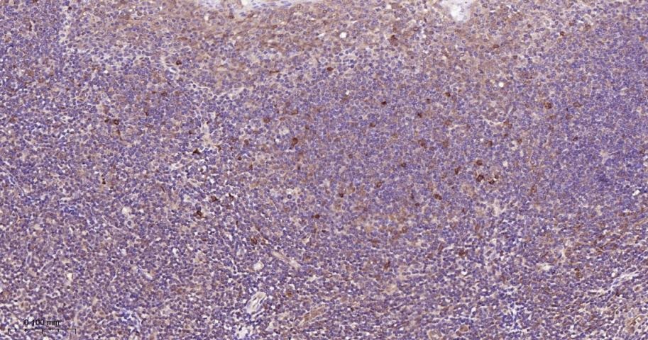 Anti-STAT3 Antibody (9V551)