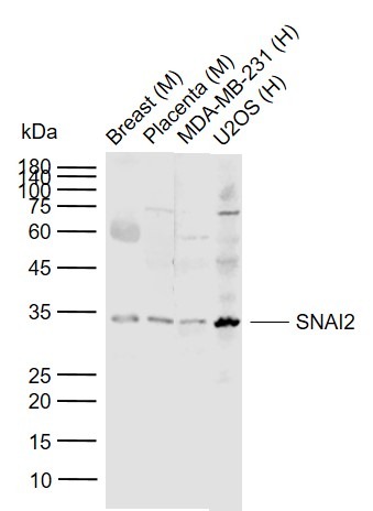 Anti-SNAI2 Polyclonal Antibody