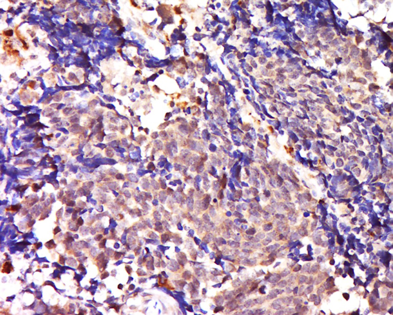 Anti-SNAI2 Polyclonal Antibody