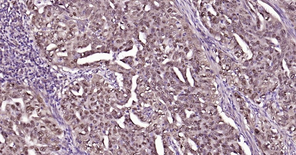 Anti-SNAI1 Polyclonal Antibody