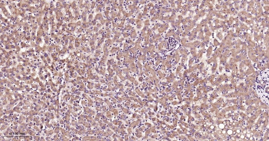 Anti-STAT3 Polyclonal Antibody 2