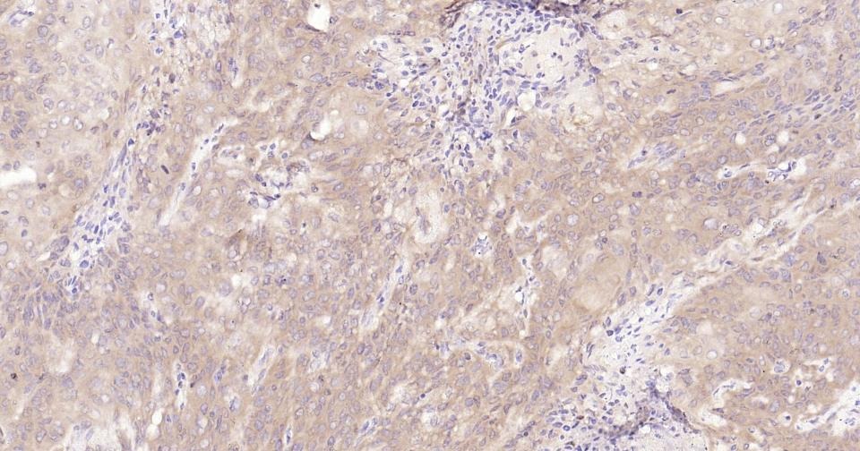 Anti-STAT3 Antibody (3R504)