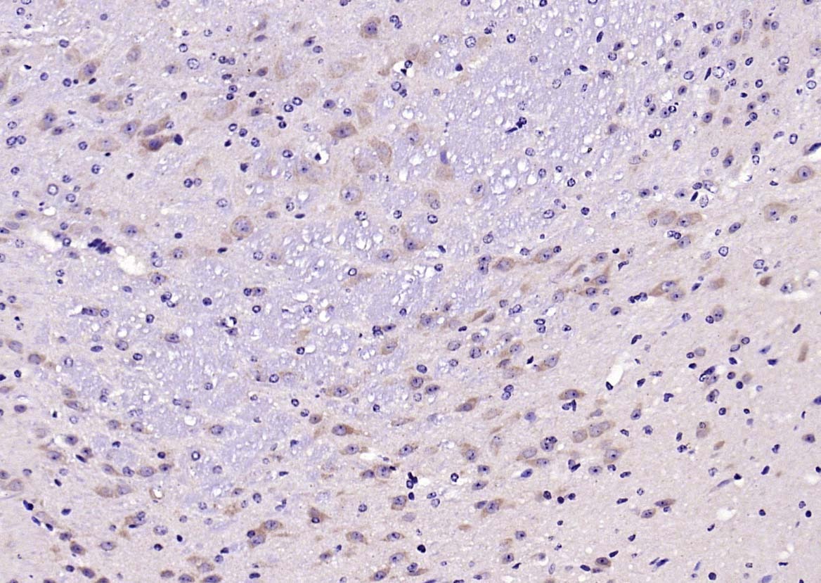 Anti-SOD2 Polyclonal Antibody 2