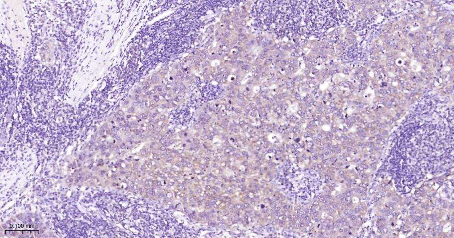 Anti-STAT3 Antibody (7U765)