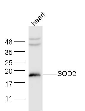 Anti-SOD2 Polyclonal Antibody