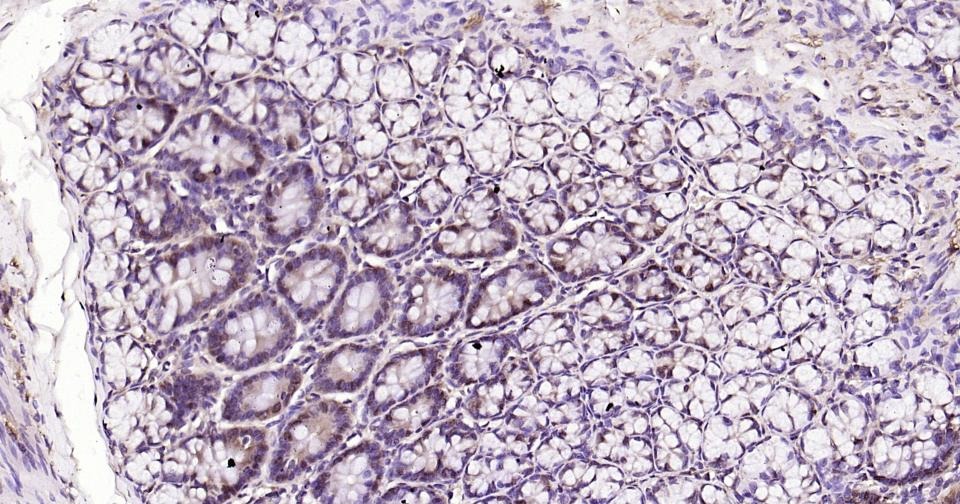 Anti-SNAI1 Polyclonal Antibody