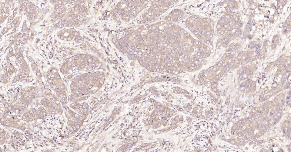 Anti-STAT3 Antibody (3R504)