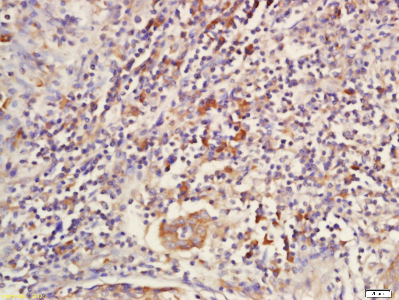 Anti-SOST Polyclonal Antibody