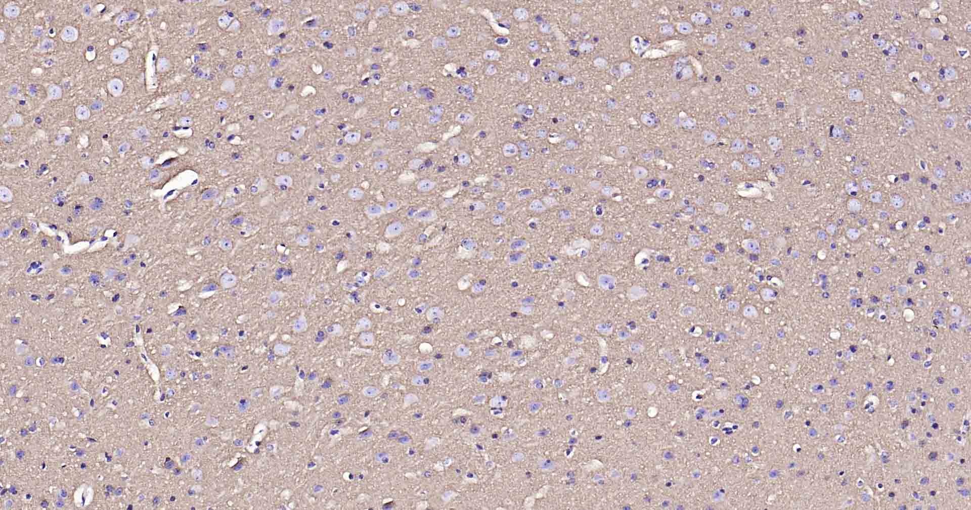 Anti-Sodium Potassium ATPase Antibody (8O42)