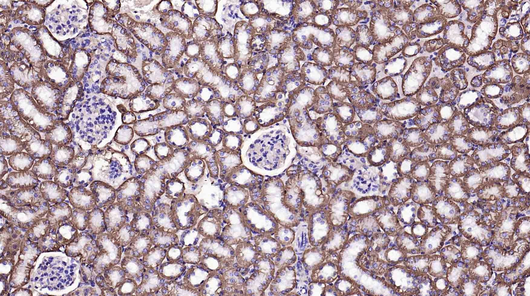 Anti-Sodium Potassium ATPase Antibody (8O42)