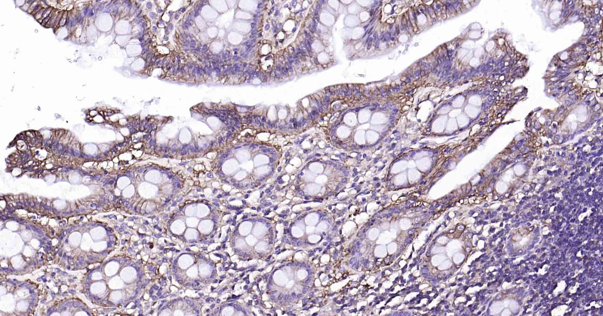 Anti-Sodium Potassium ATPase Antibody (8O42)