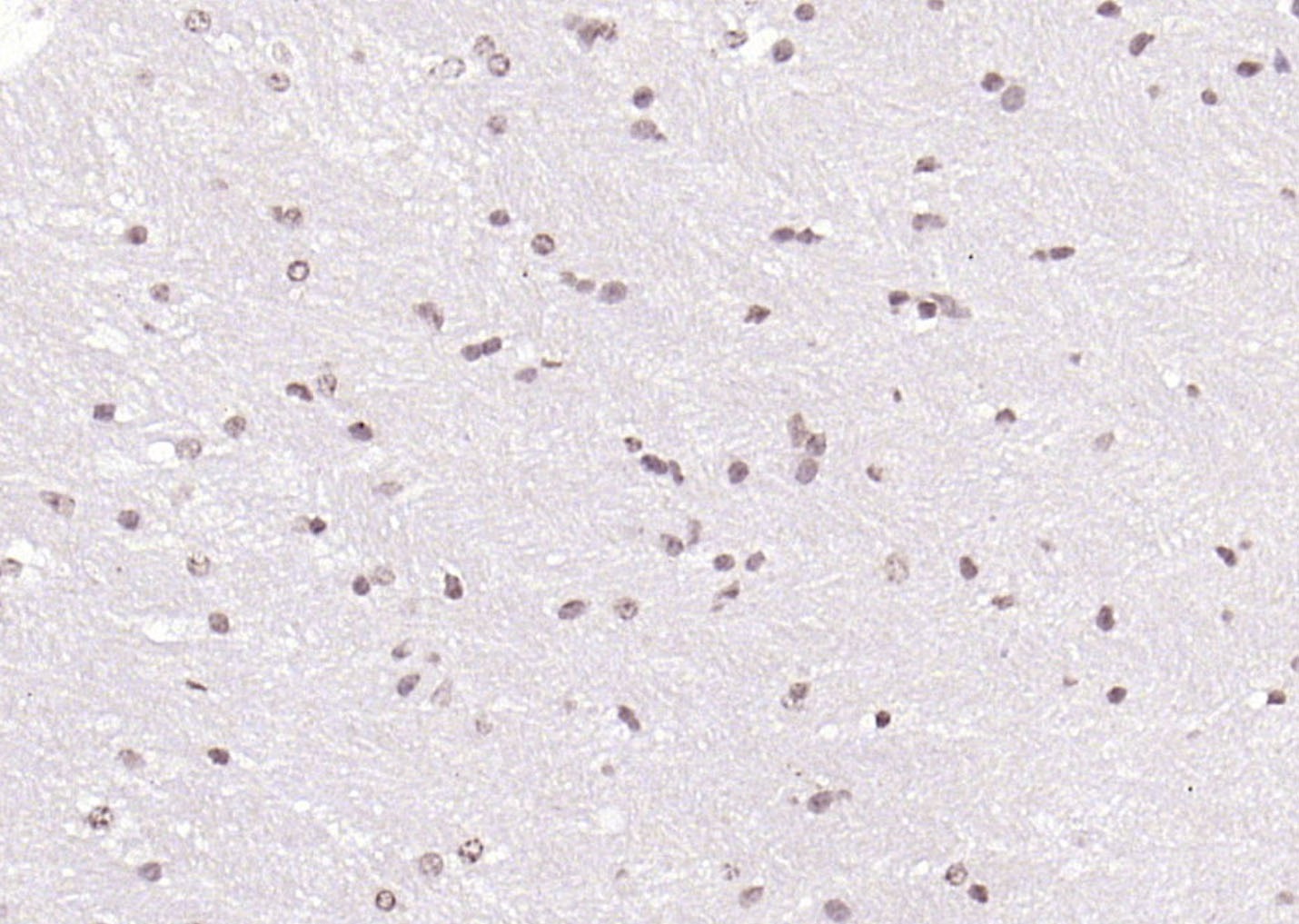 Anti-SOX4 Polyclonal Antibody