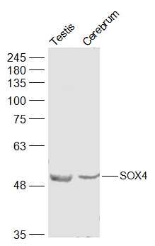 Anti-SOX4 Polyclonal Antibody