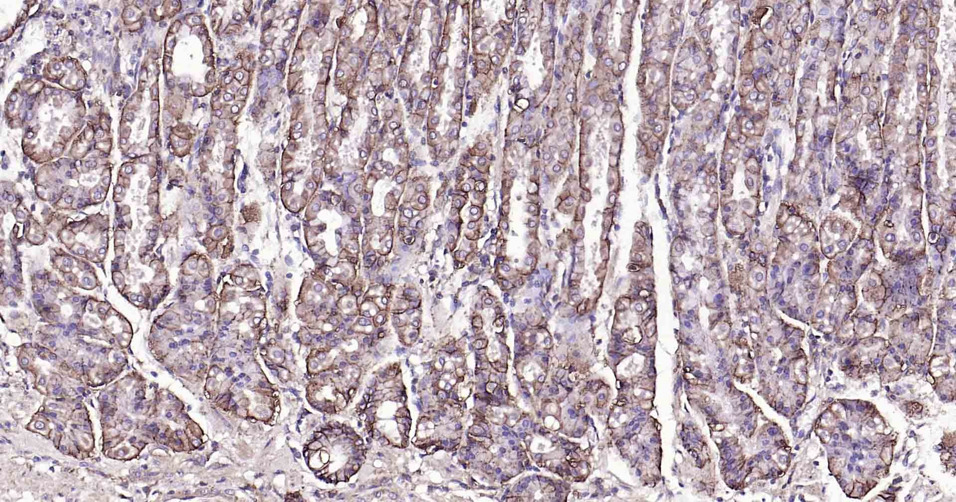 Anti-Sodium Potassium ATPase Antibody (8O42)