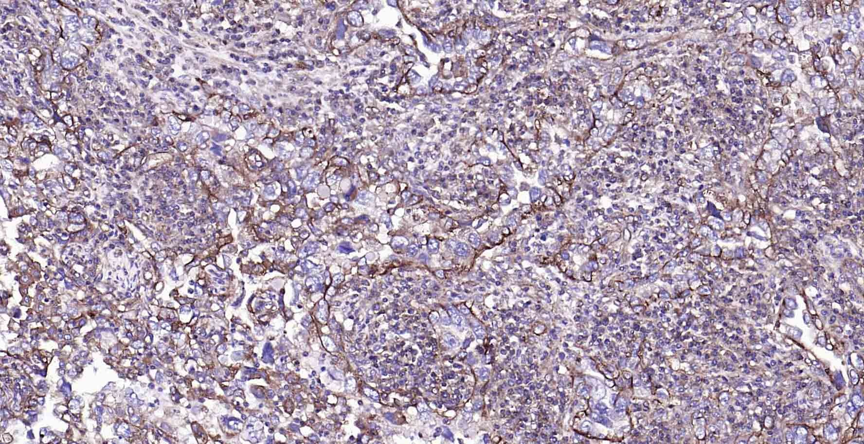 Anti-Sodium Potassium ATPase Antibody (8O42)