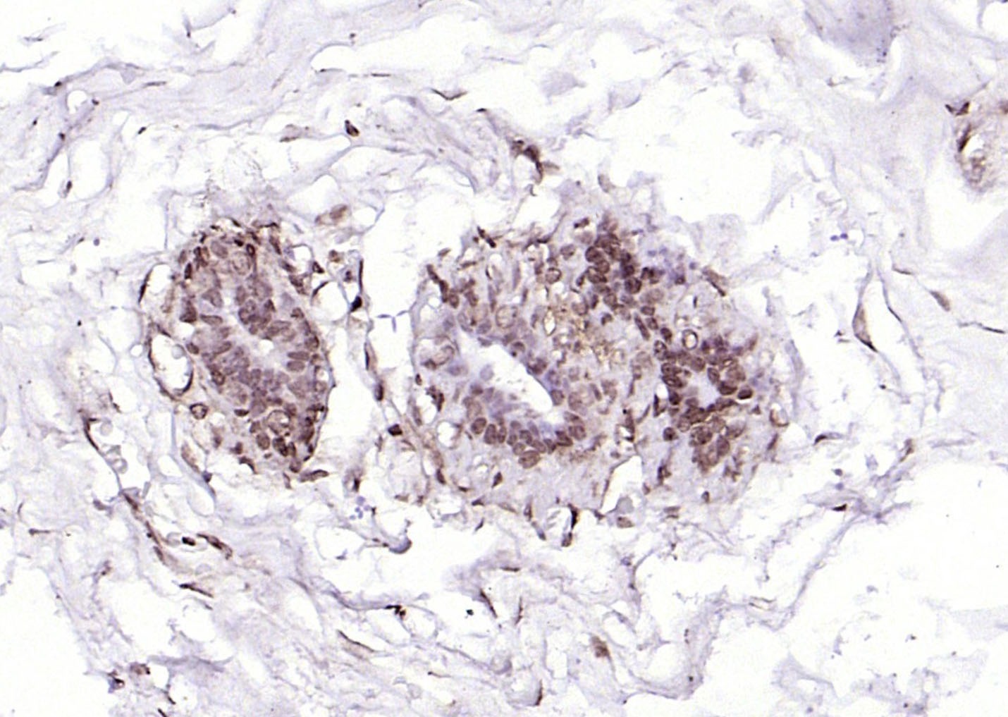 Anti-SOX4 Polyclonal Antibody