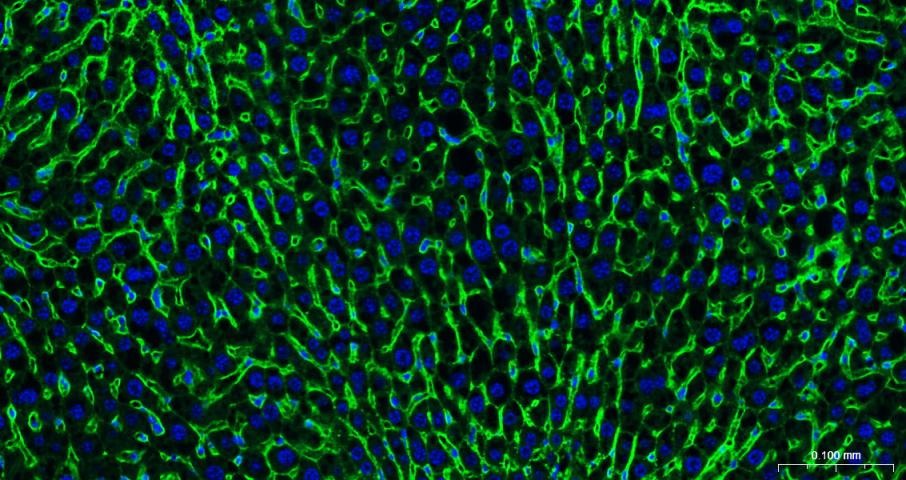 Anti-Sodium Potassium ATPase Antibody (8O42)