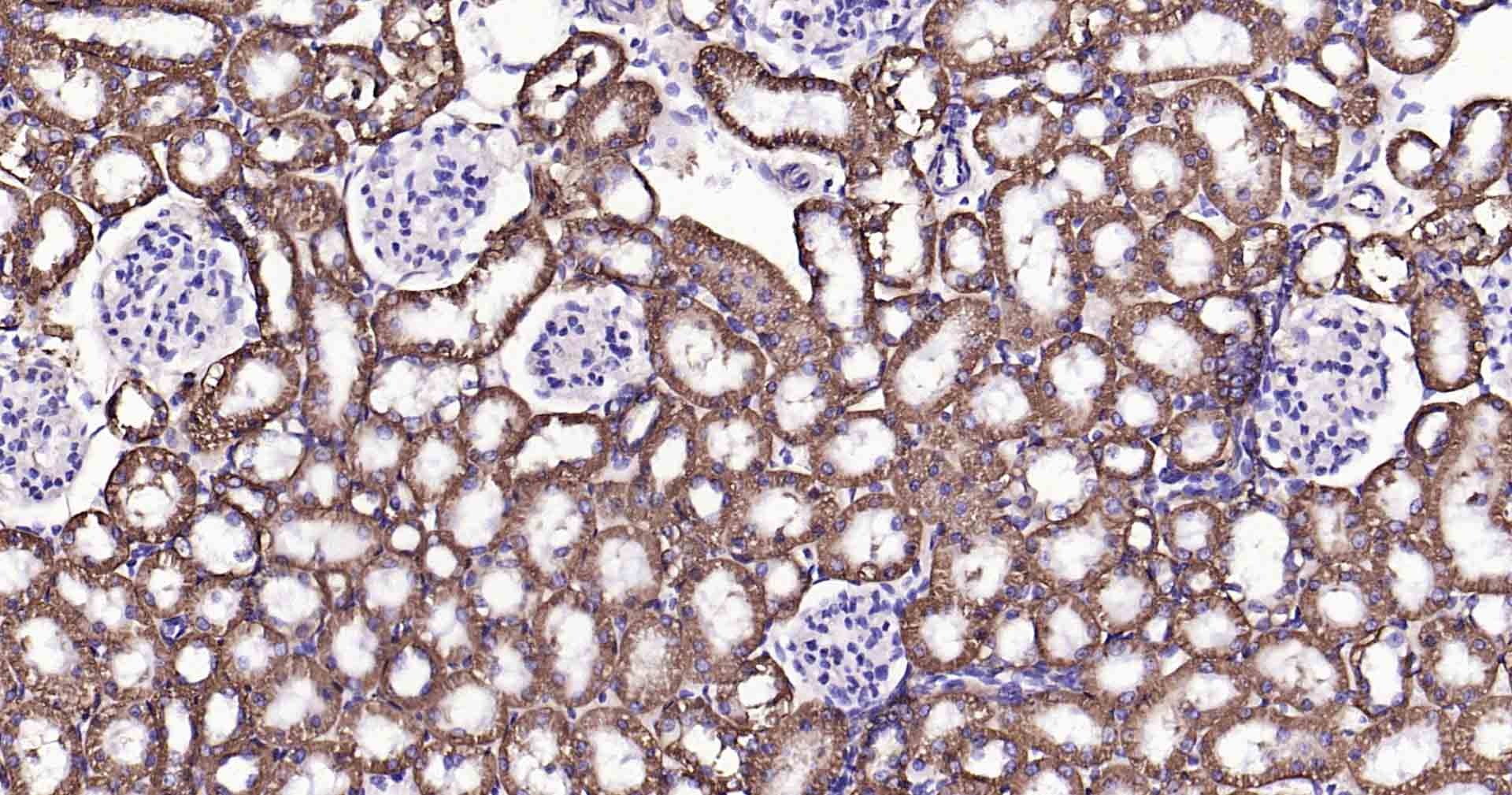 Anti-Sodium Potassium ATPase Antibody (8O42)