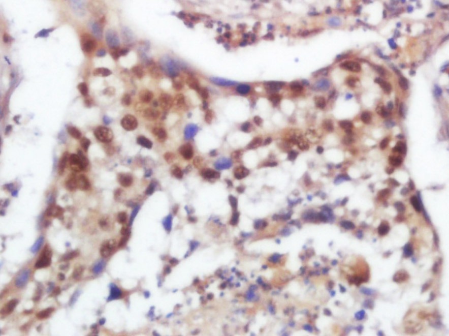 Anti-SOX9 Polyclonal Antibody