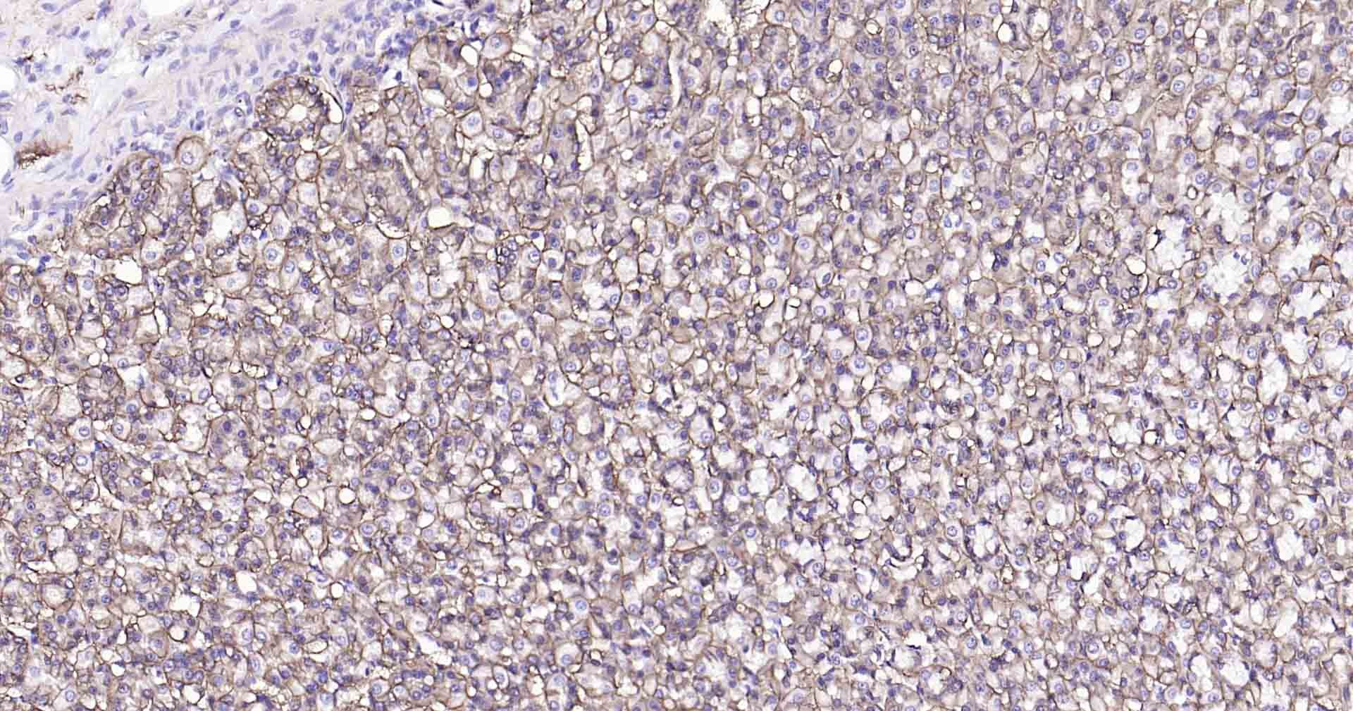 Anti-Sodium Potassium ATPase Antibody (8O42)