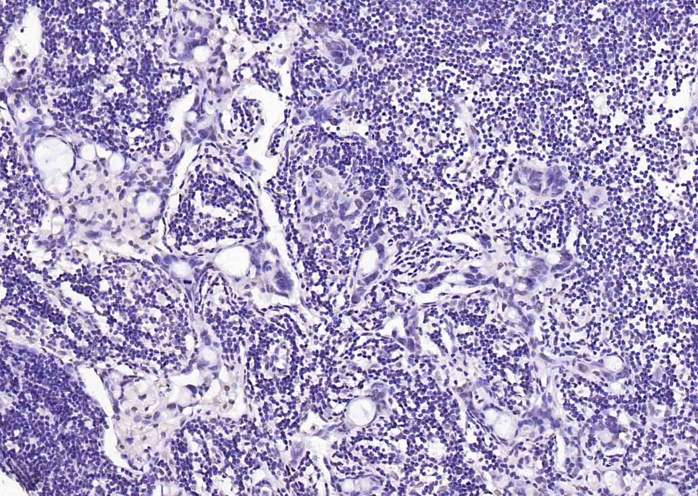 Anti-SOX9 Polyclonal Antibody