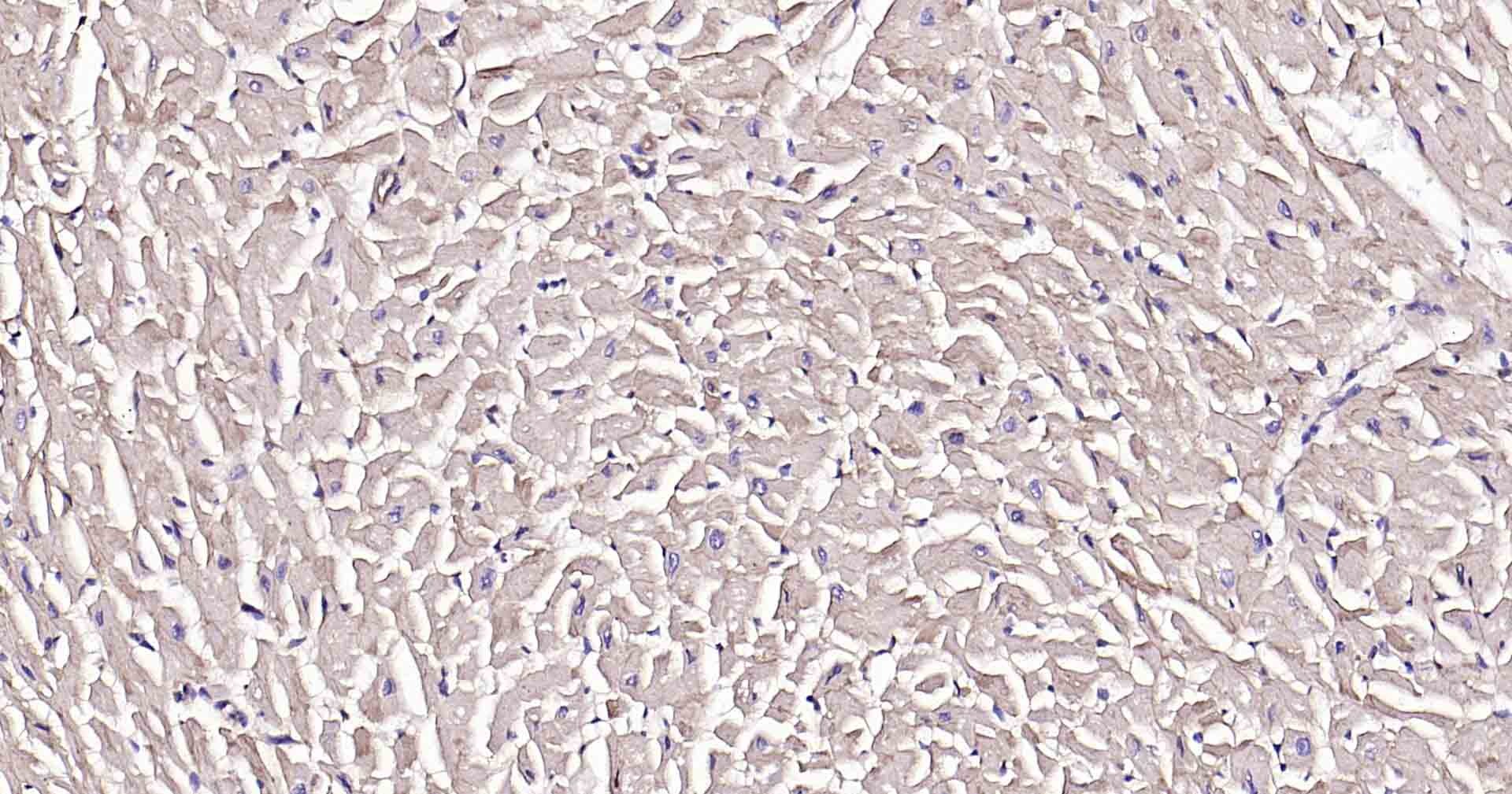 Anti-Sodium Potassium ATPase Antibody (8O42)