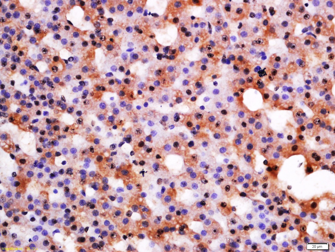 Anti-CRHR1 Polyclonal Antibody