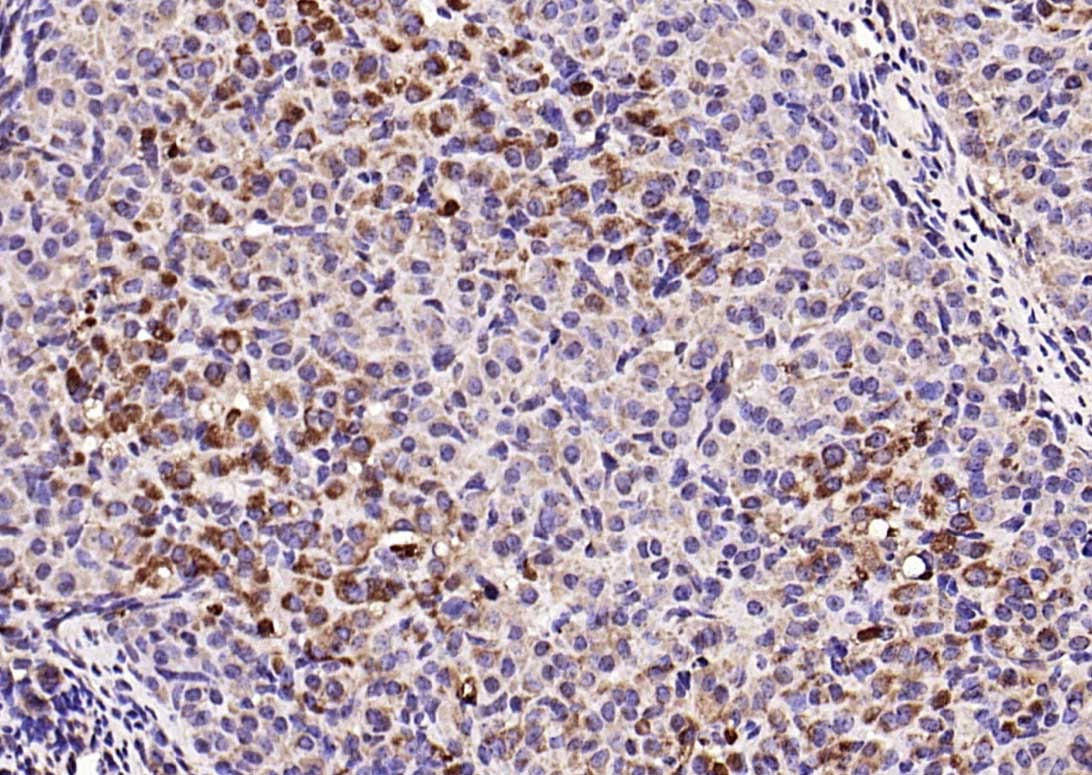 Anti-C-Kit Polyclonal Antibody