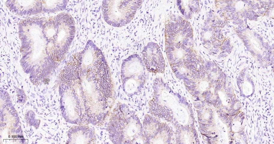 Anti-Claudin-1 Antibody (2P425)