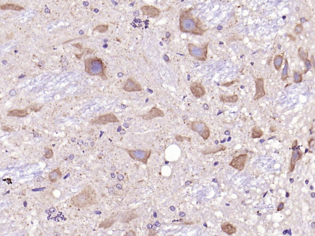 Anti-C-Kit Polyclonal Antibody