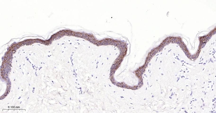 Anti-Claudin-1 Antibody (2P425)