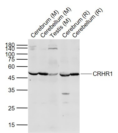 Anti-CRHR1 Polyclonal Antibody